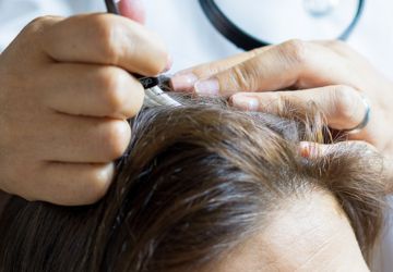 Guia Terapêutico de 5 Dias STD – Couro Cabeludo e Pescoço